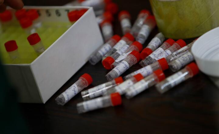 Laboratorium / autor: PAP/EPA/LYNN BO BO