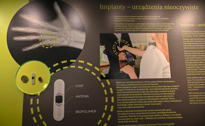 Implant płatniczy  / autor: NBP 