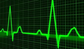 COVID-19: Osoby z arytmią narażone na dodatkowe zaburzenia pracy serca
