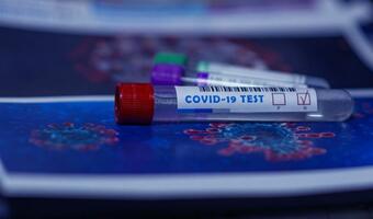 Test odporności na COVID-19 zbada kilka rodzajów przeciwciał