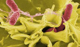 Salmonella bardziej niebezpieczna niż myślisz