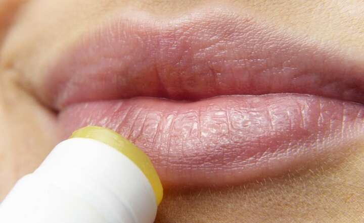  Opryszczkę zwykłą powoduje wirus o nazwie herpes simplex 1 / autor: Pixabay
