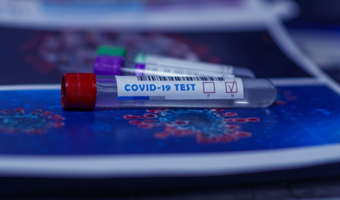 Pracownicy oczekują bezpłatnego dostępu do testów na COVID-19