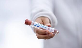 Wirusolog: jest nadzieja, że zakażeń będzie mniej