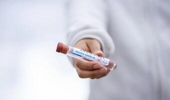 Test na Covid to koszt firmy, nawet dla samozatrudnionych