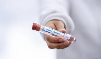 Opracowano nowy, szybki i tani test na COVID-19